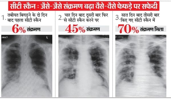 RT-PCR में कोरोना निगेटिव होने पर भ